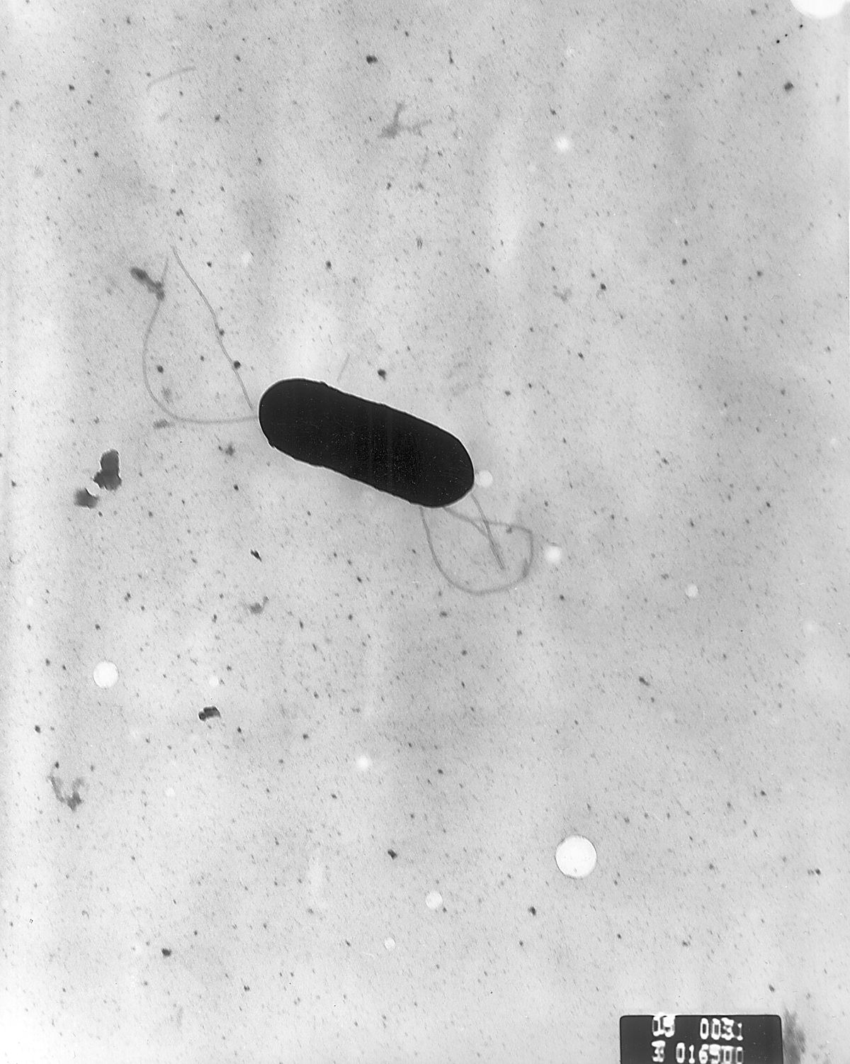 Listeria